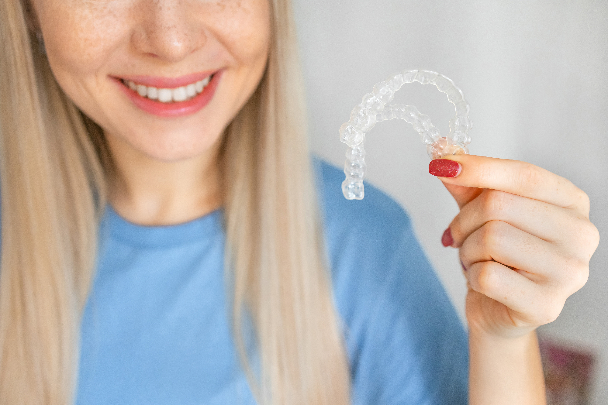 Konkurenčna Invisalign cena za popoln nasmeh